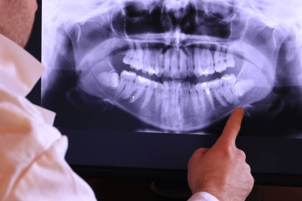 Best Emergency Dentist for Special Needs Patients in South Barrington, IL