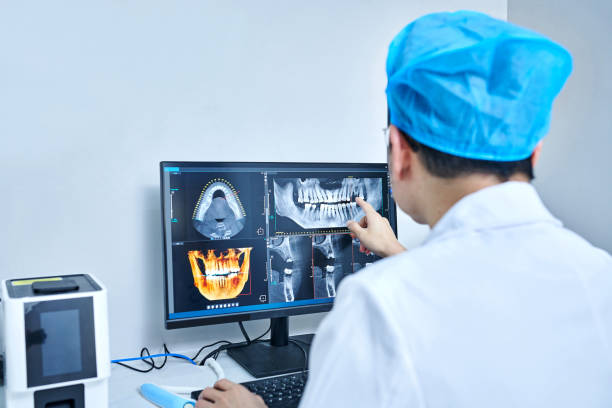 Best Emergency Dentist for Lost Fillings or Crowns in South Barrington, IL